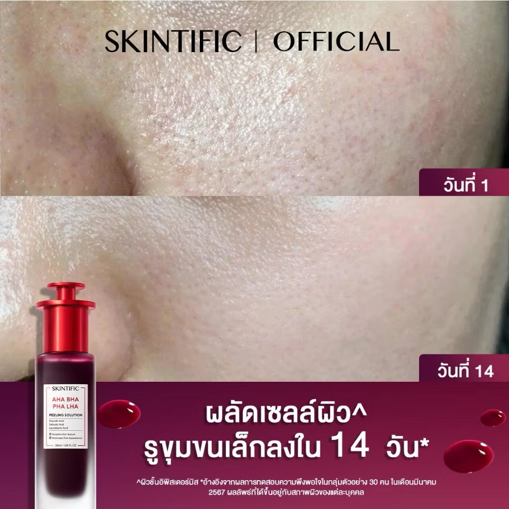 SKINTIFIC 5x Ceramide Moisturiser Gel 30g & AHA Peeling Solution 20ml (เซ็ตผลัดเซลล์ผิว)