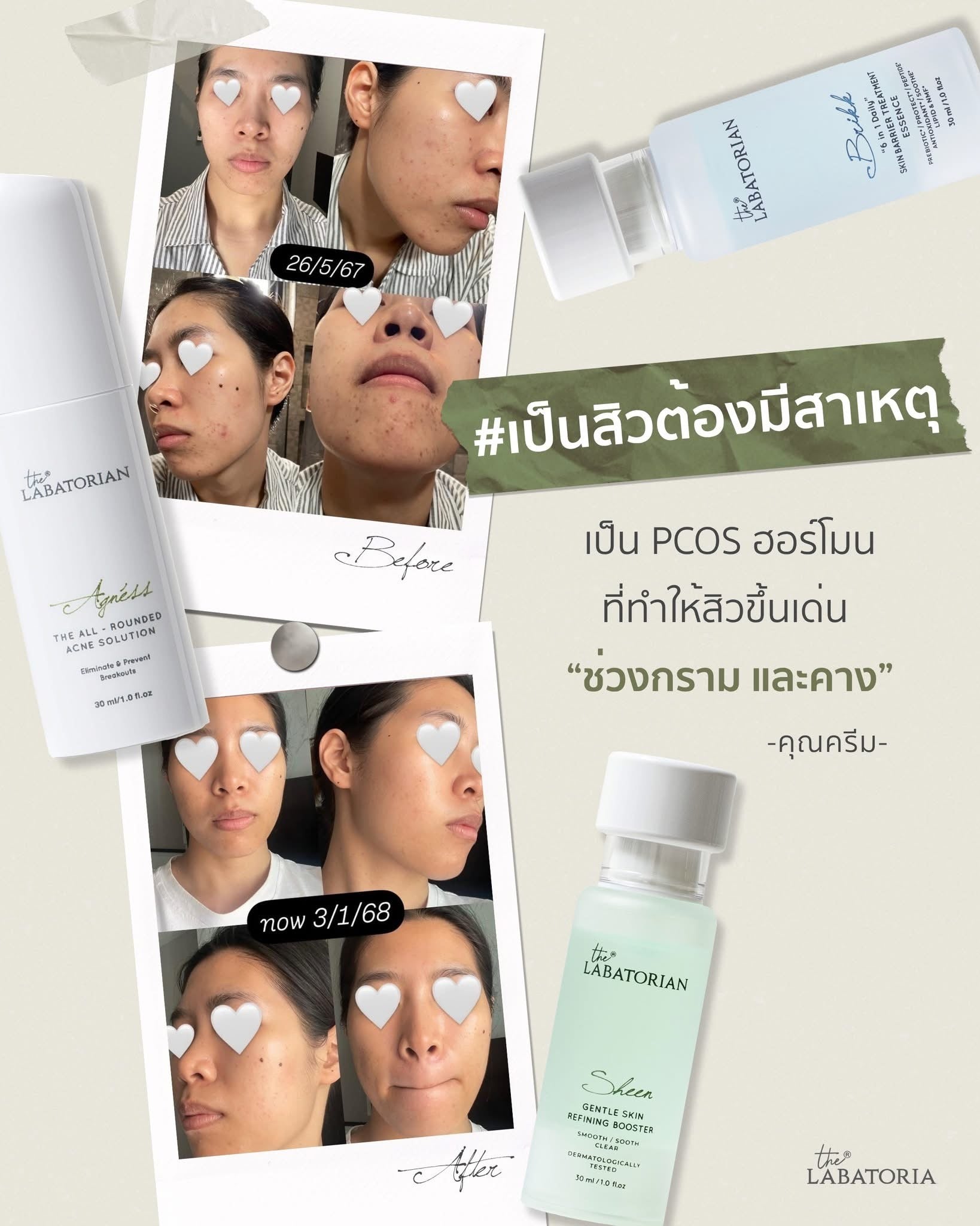 The Labatorian Sheen Gentle Skin Refining Booster คุณ โดนัท เพื่อผิวเรียบใส ไร้อุดตัน 30ml