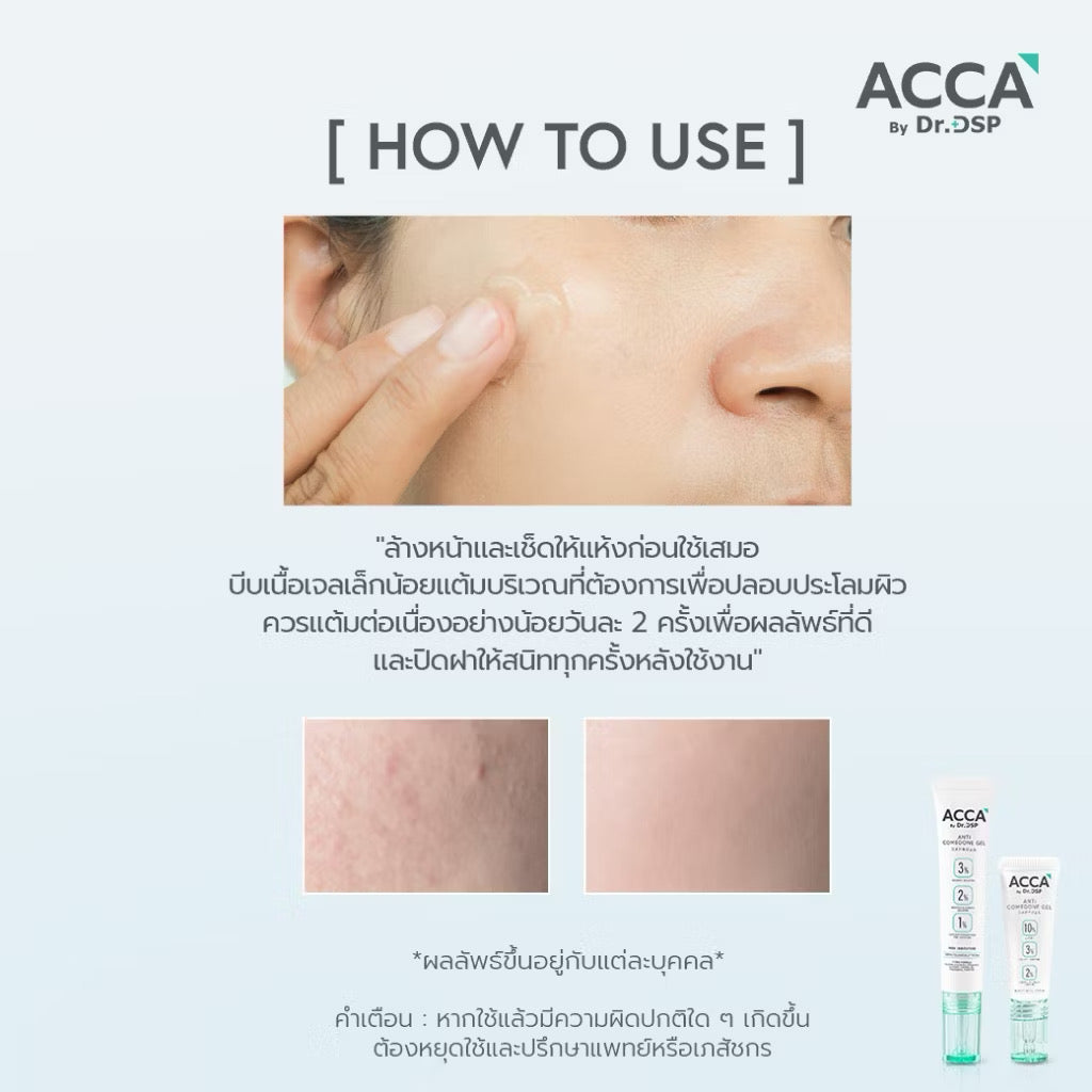 💚 Acca by Dr. DSP Anti Comdone Gel เวชสำอาง #เจลแต้มสิวผด จัดการปัญหาสิวอุดตัน 15g ⛔️13/5