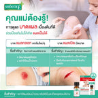 Smooth E เจลเคลือบปิดแผล Skin Liquid Plaster 4ml. กันน้ำ ใช้แทนพลาสเตอร์ กันถลอก ป้องกันเชื้อโรค