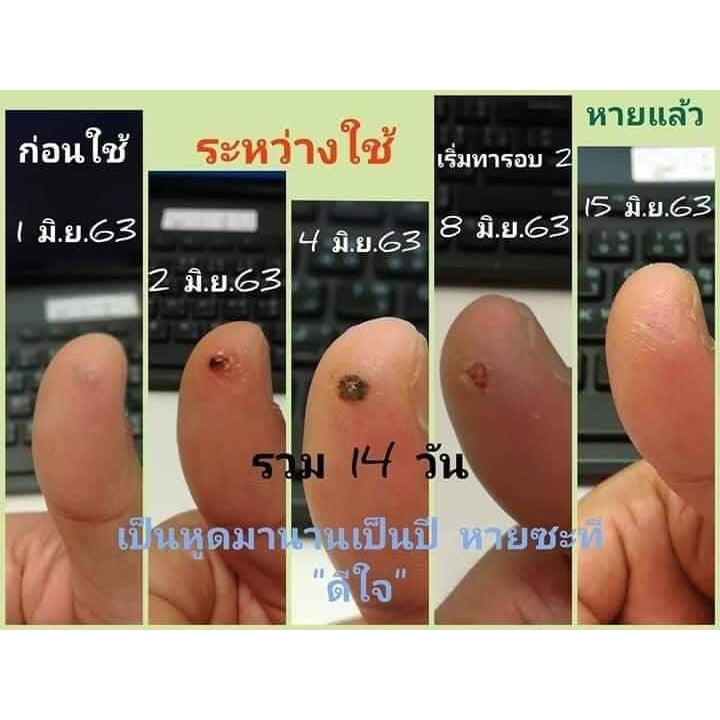 ครีมจีจี้ กำจัดไฝ ขี้แมลงวัน หูด ตาปลา สูตรสมุนไพรโบราณ 5g.
