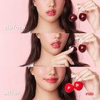 Cherry Nipple Treatment ครีมทาจุก ครีมทาหัวนมชมพู ช่วยปรับสีให้ชมพูสว่างกระจ่างใส | missBBgirl