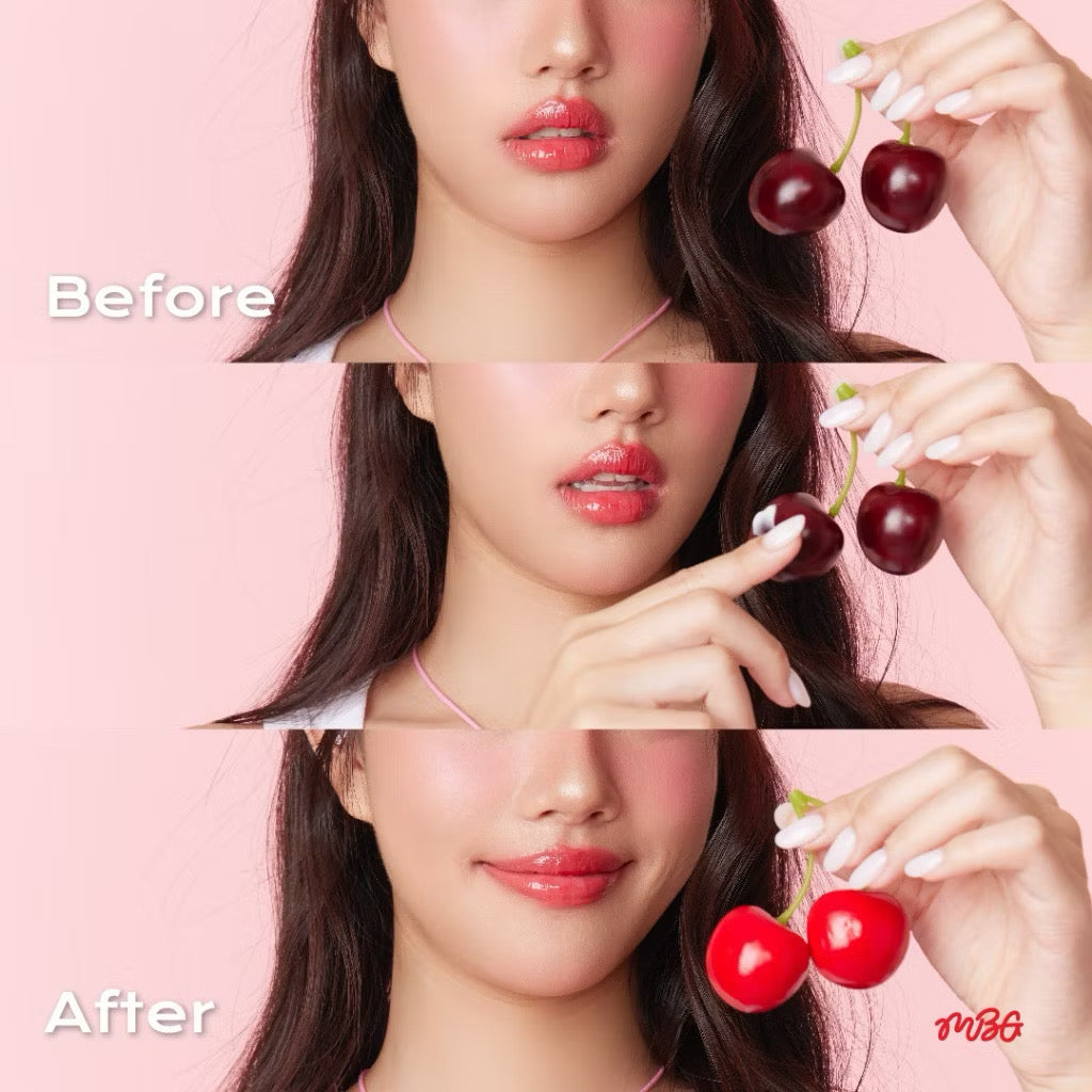 Cherry Nipple Treatment ครีมทาจุก ครีมทาหัวนมชมพู ช่วยปรับสีให้ชมพูสว่างกระจ่างใส | missBBgirl