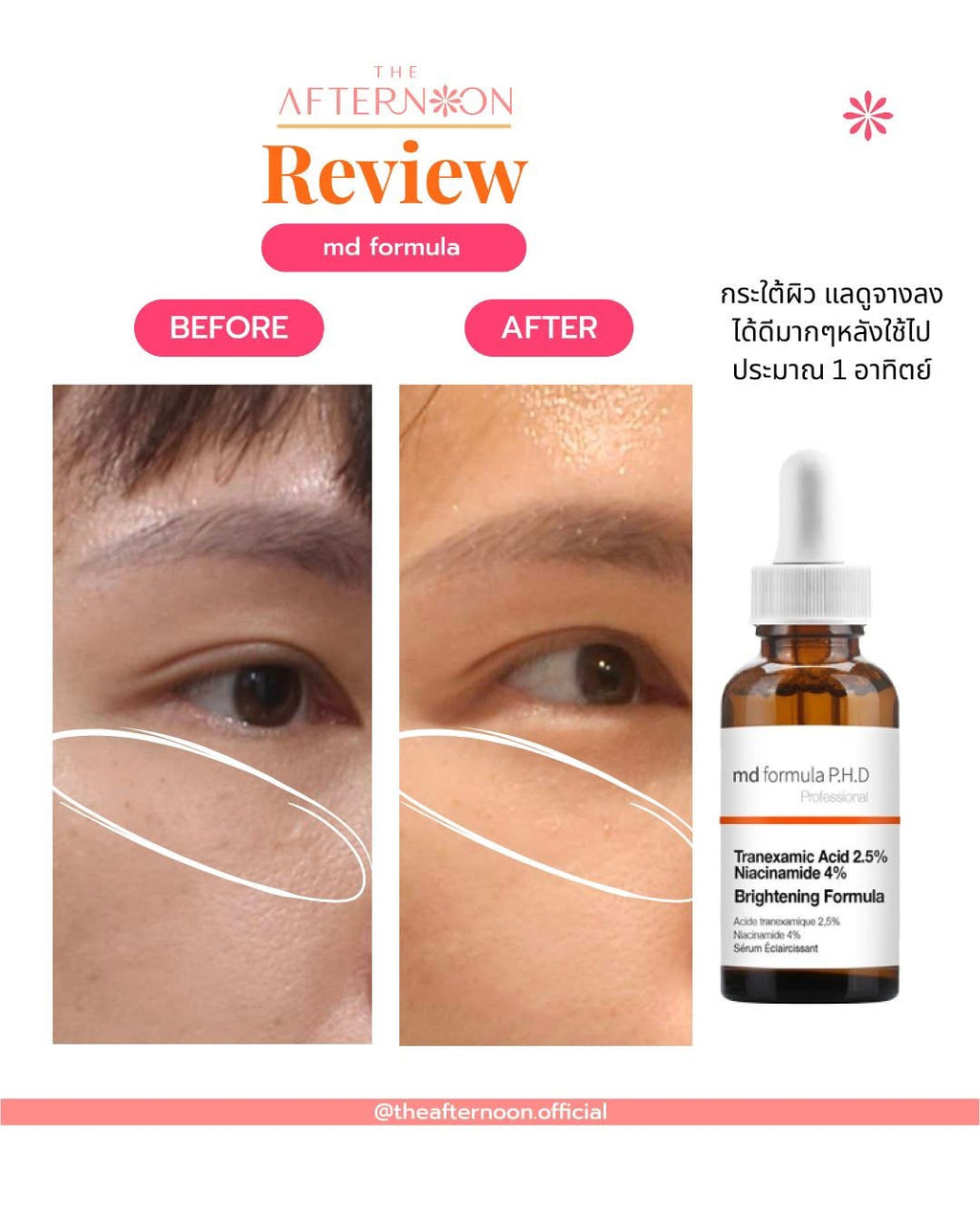 ⛔️ (Pre-order) The Afternoon MD Formula Brightening Serum เซรั่มปรับผิวกระจ่างใส 30ml