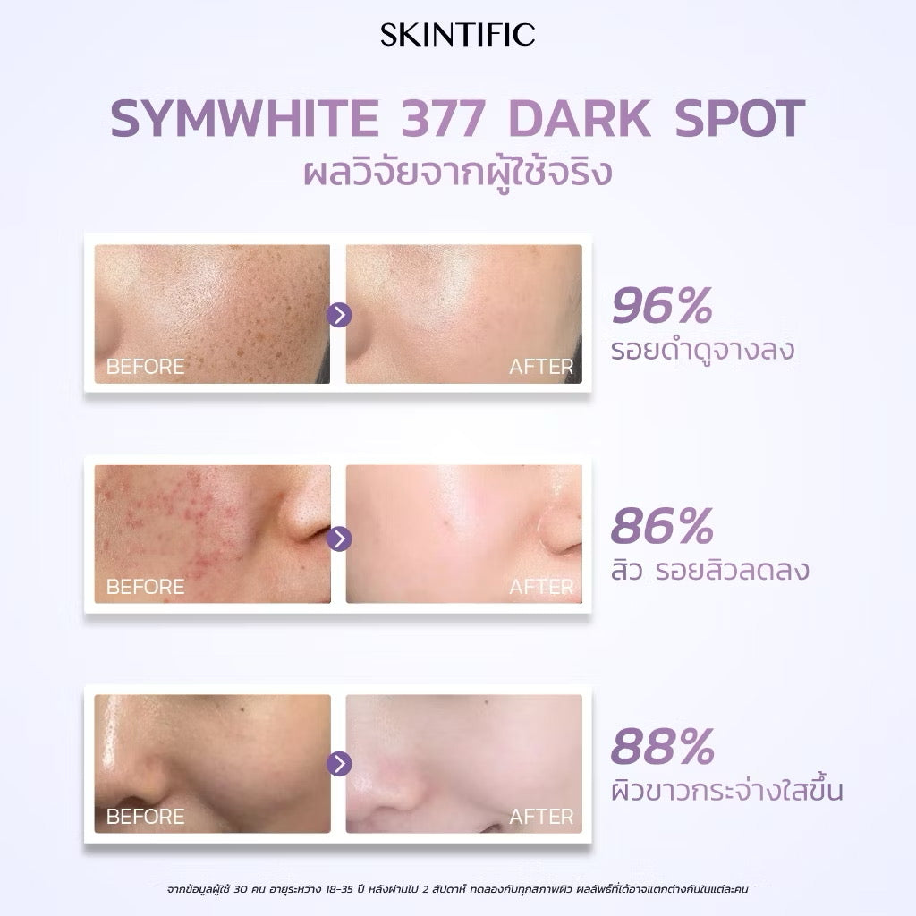 SKINTIFIC Dark Spot Serum เซรั่มลดจุดด่างดำ ฝ้า กระ 50 ml