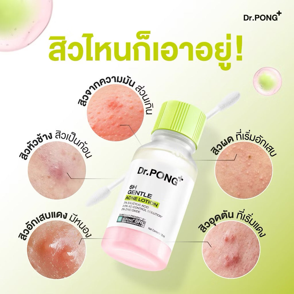 Dr.PONG 6H GENTLE ACNE LOTION แป้งน้ำแต้มสิว สิวยุบใน 1 คืน แห้งไว ไม่ทิ้งรอย ไม่ขึ้บนซ้ำ 15ml