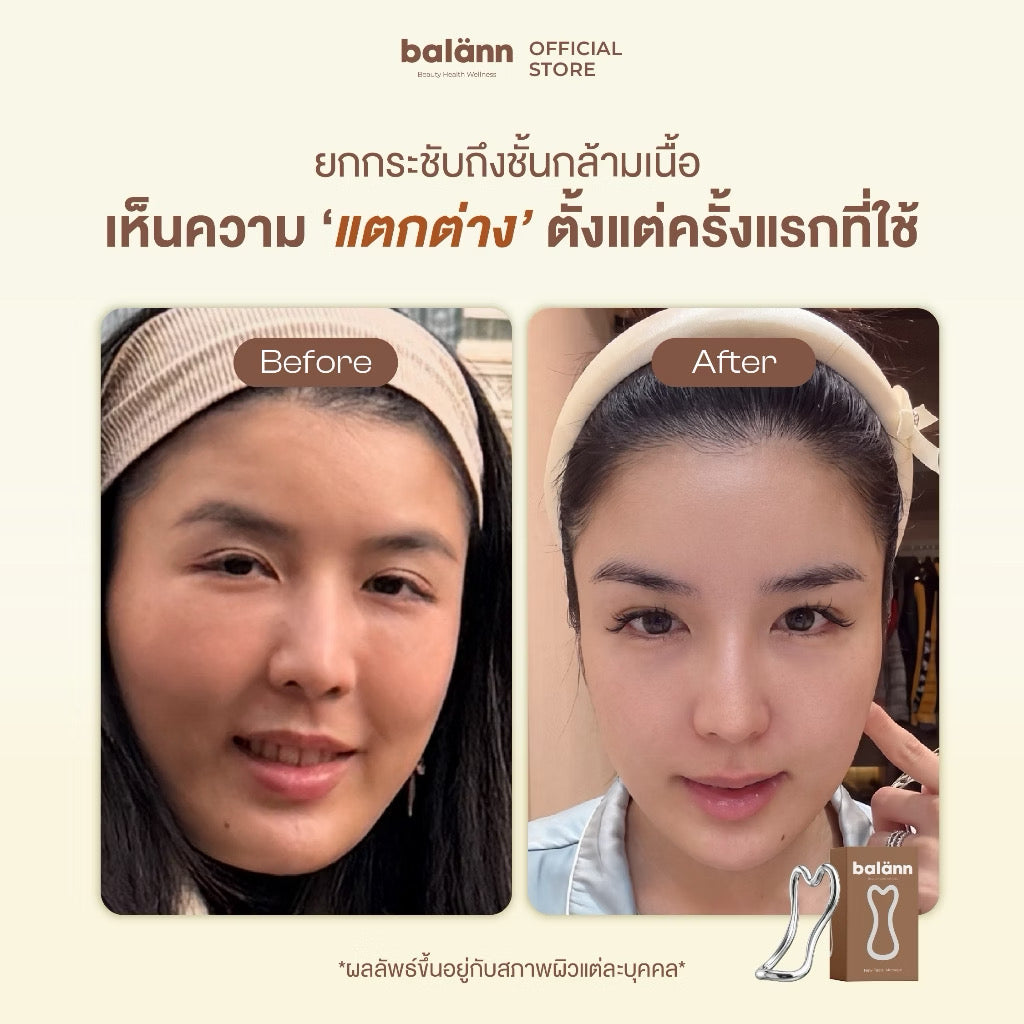 ⛔️(Pre-order)กัวซาเกาหลี balann เน้นการยกกระชับ ปรับรูปหน้า ลงลึกถึงชั้นกล้ามเนื้อ (1 ชิ้น)