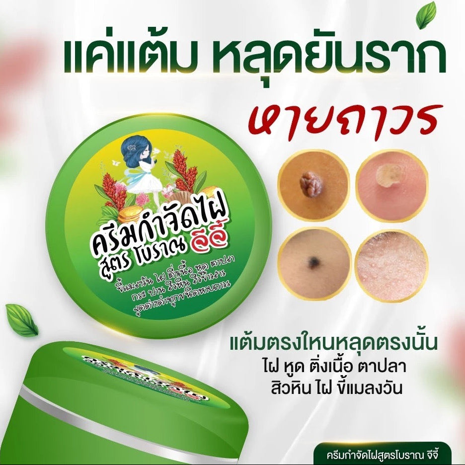 ครีมจีจี้ กำจัดไฝ ขี้แมลงวัน หูด ตาปลา สูตรสมุนไพรโบราณ 5g.