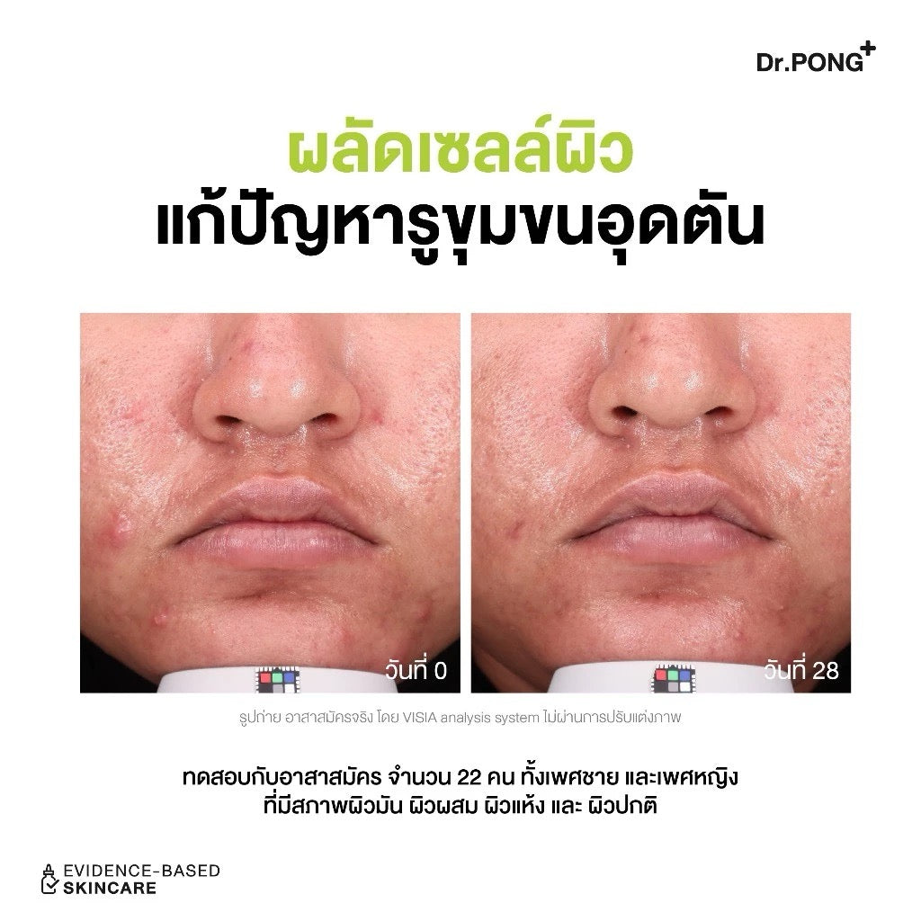 DR.PONG P55 Acne clear face wash เจลล้างหน้าสูตรอ่อนโยน สำหรับผิวเป็นสิว 100ml