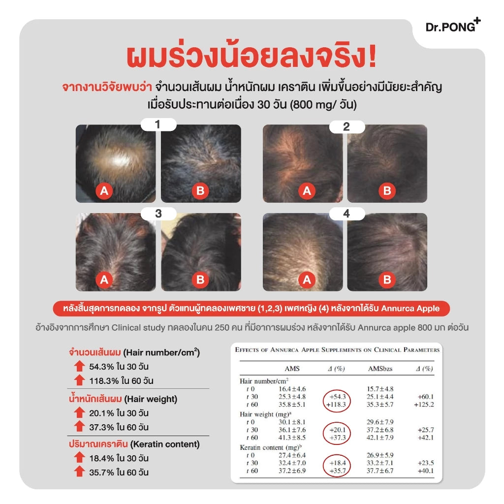 ⛔️ (Pre-order )Dr.PONG ANA-X 30 ลดผมร่วง เพิ่มจำนวนและความแข็งแรงของเส้นผม 30 แคปซูล
