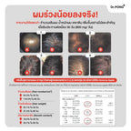 ⛔️ (Pre-order )Dr.PONG ANA-X 30 ลดผมร่วง เพิ่มจำนวนและความแข็งแรงของเส้นผม 30 แคปซูล