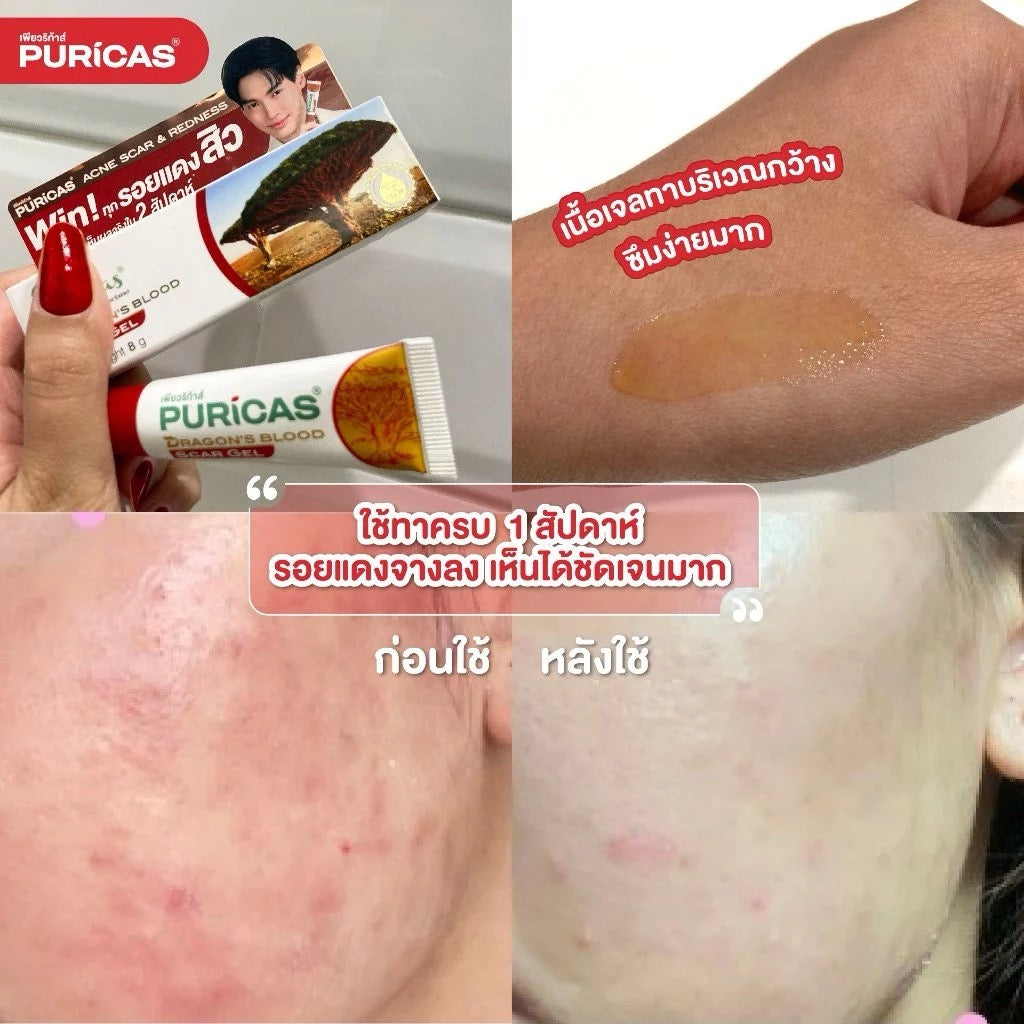 PURICAS Dragon’s Blood Scar Gel   ลดเลือนรอยแดงจากสิว 8g