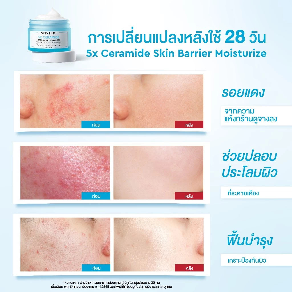 ⛔️ (Pre-order) SKINTIFIC 5X Ceramide Barrier Moisturizer Gel มอยส์เจอร์ไรเซอร์เจล เติมความชุ่มชื้น 80g.