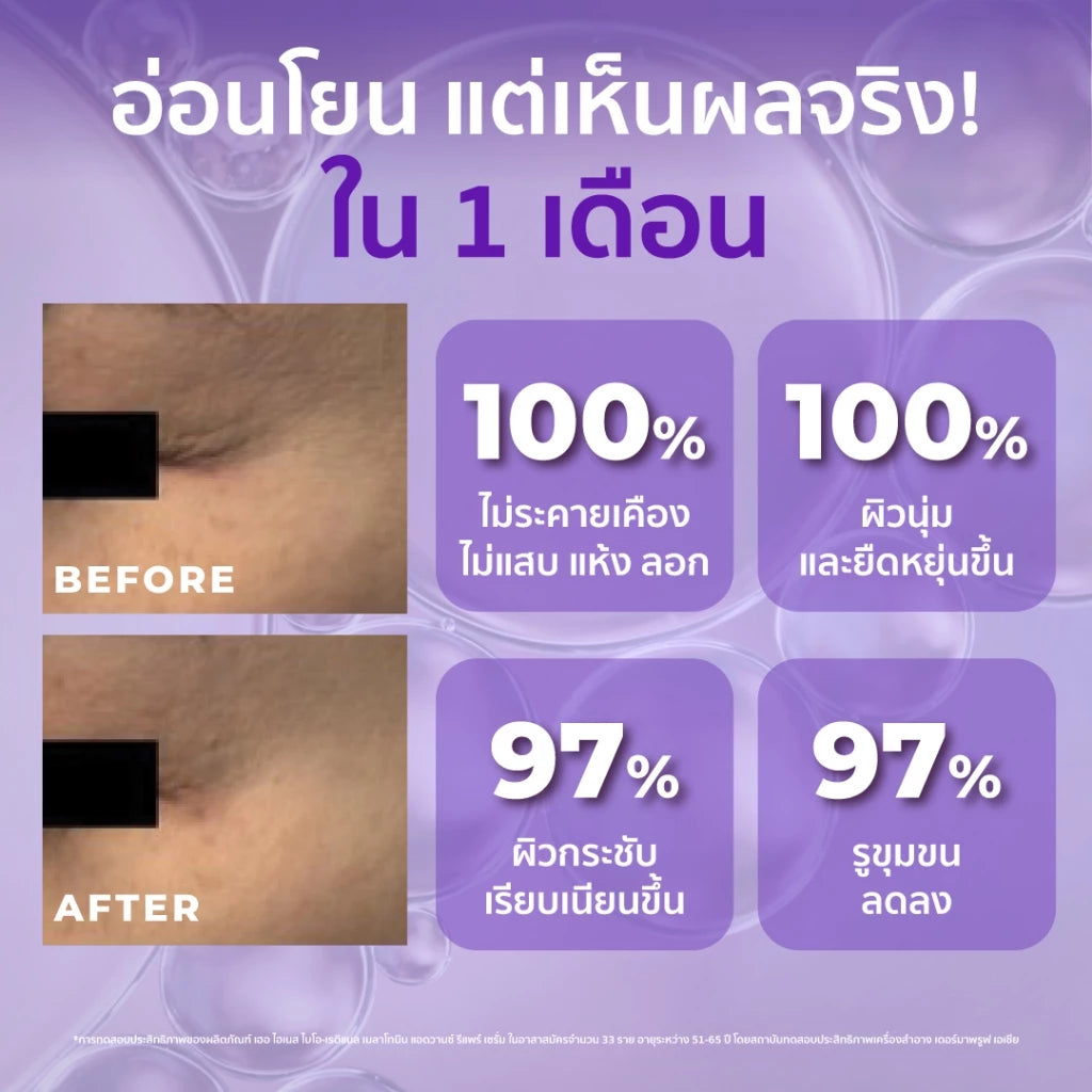 ⛔️ (Pre-order) Her Hyness Bio-Retinal Melatonin Advanced Repair Serum เซรั่มเรติแนลบำรุงผิวยามค่ำคืน 30ml