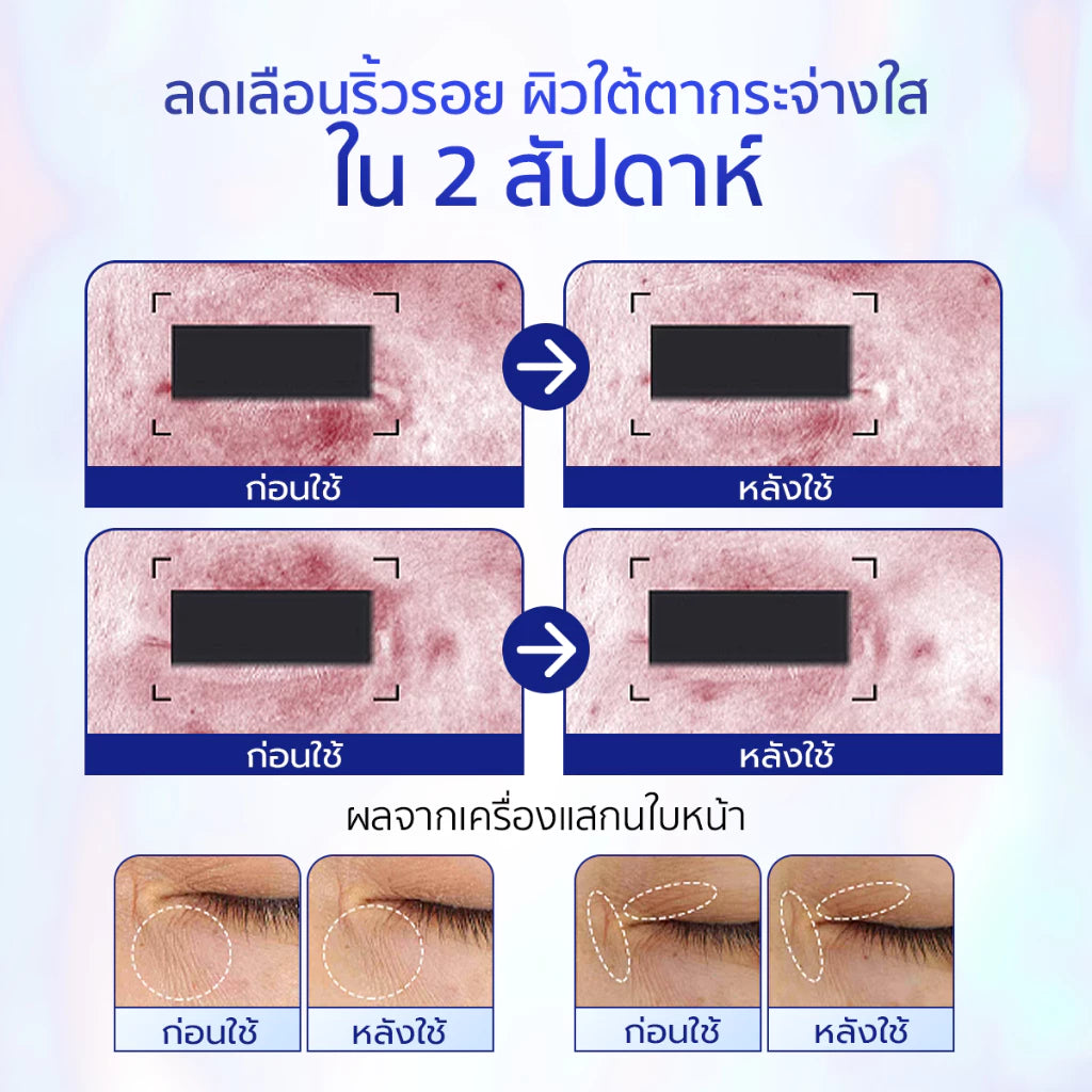 ⛔️ (Pre-order) SKINTIFIC 360 Crystal Massager Lifting Eye Cream อายครีมบำรุงรอบดวงตา 20g.