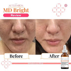 ⛔️ (Pre-order) The Afternoon MD Formula Brightening Serum เซรั่มปรับผิวกระจ่างใส 30ml