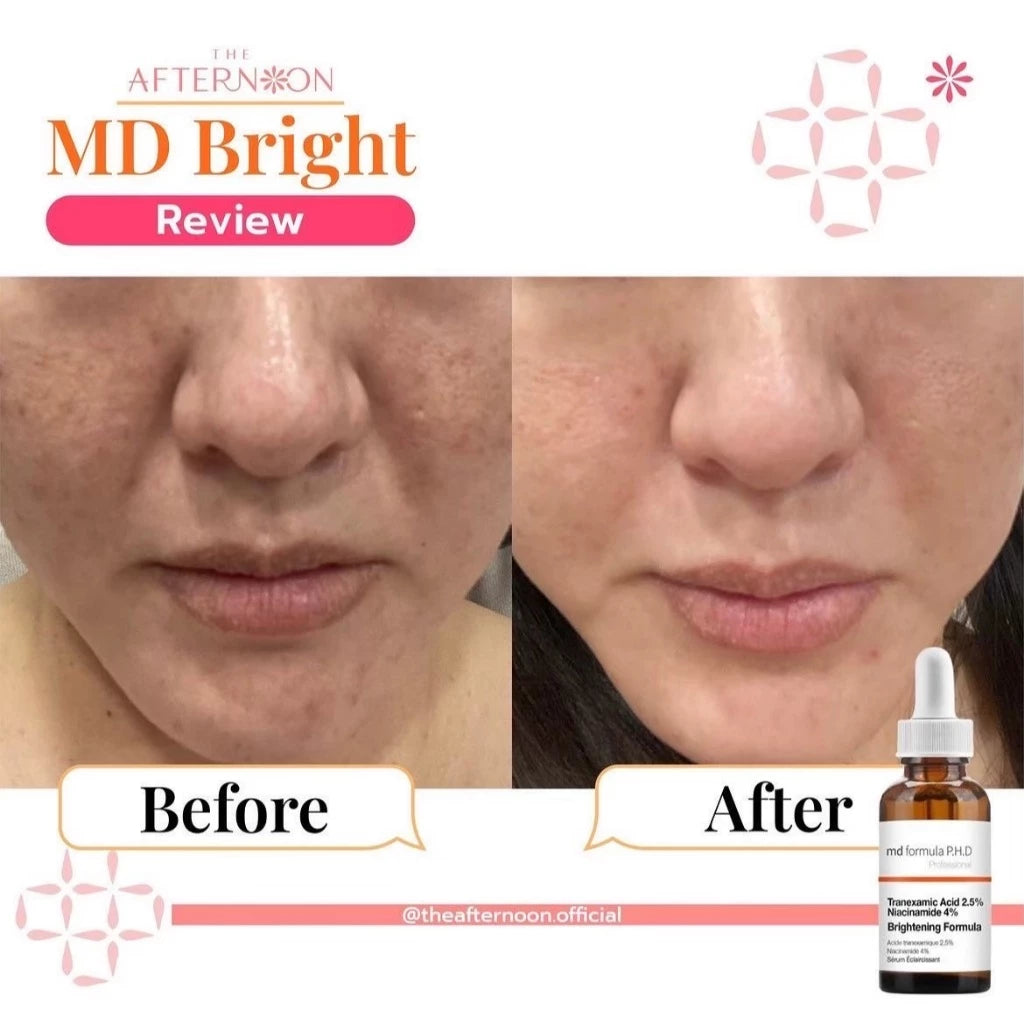 ⛔️ (Pre-order) The Afternoon MD Formula Brightening Serum เซรั่มปรับผิวกระจ่างใส 30ml