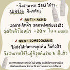 The Labatorian Agnéss The All-Rounded มอยส์เซรั่มลดสิว 30ml