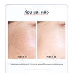 EUCERIN Spotless Brightening Gentle Cleansing Foam โฟมล้างหน้าผิวกระจ่างใส 150g.