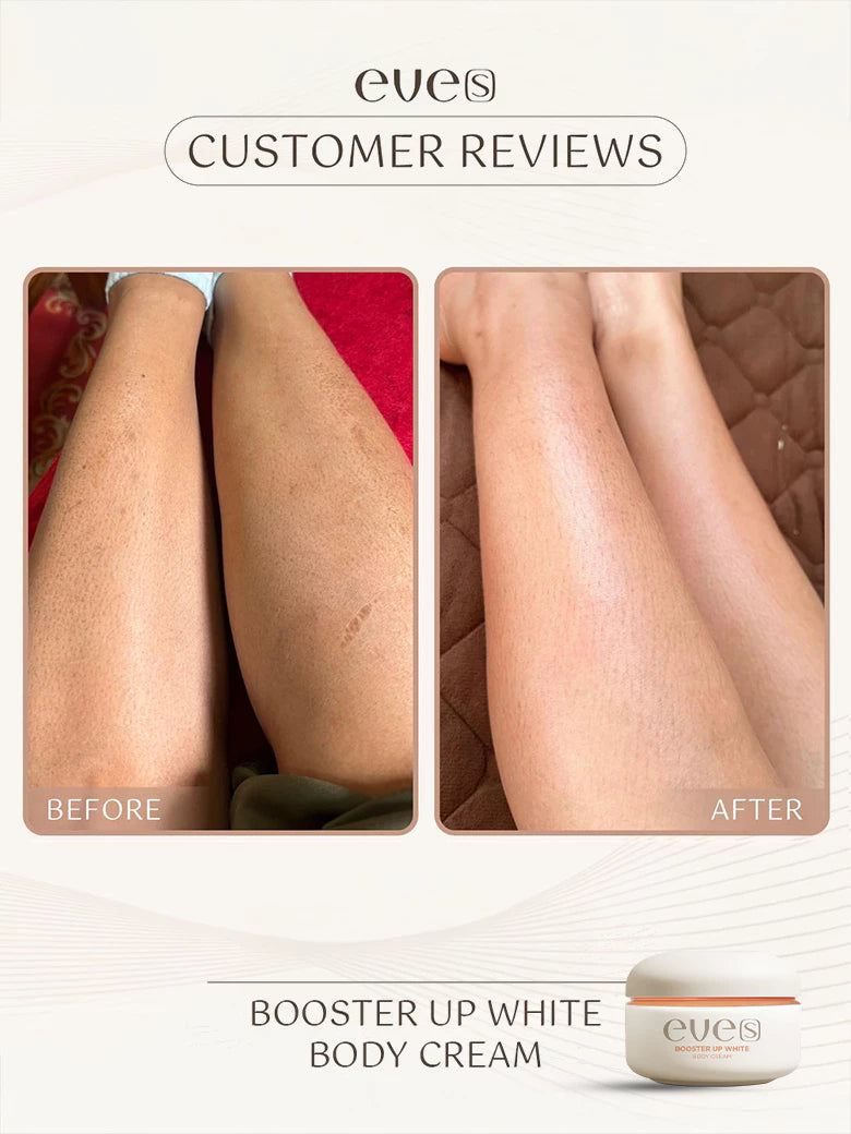 EVE’S Booster Up White Body Cream เติมความชุ่มชื้น ผิวขาว ลดเลือน จุดด่างดำ 100g.