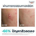 ⛔️ (Pre-order) Eucerin DERMOPURE Clinical Triple Action เซรั่มลดสิว ลดรอย คุมมัน ผิวสมดุล 40ml