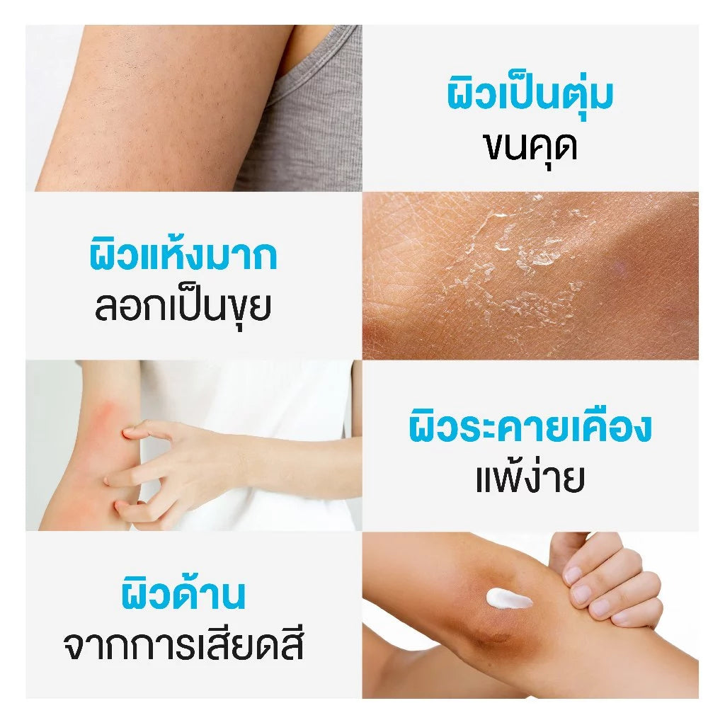 ⛔️ (Pre-order)Dr.PONG U9.9 Renewal Cream ครีมฟื้นผิวแห้งลอก ลดขนคุด ผิวนุ่มชุ่มชื้น 50 g