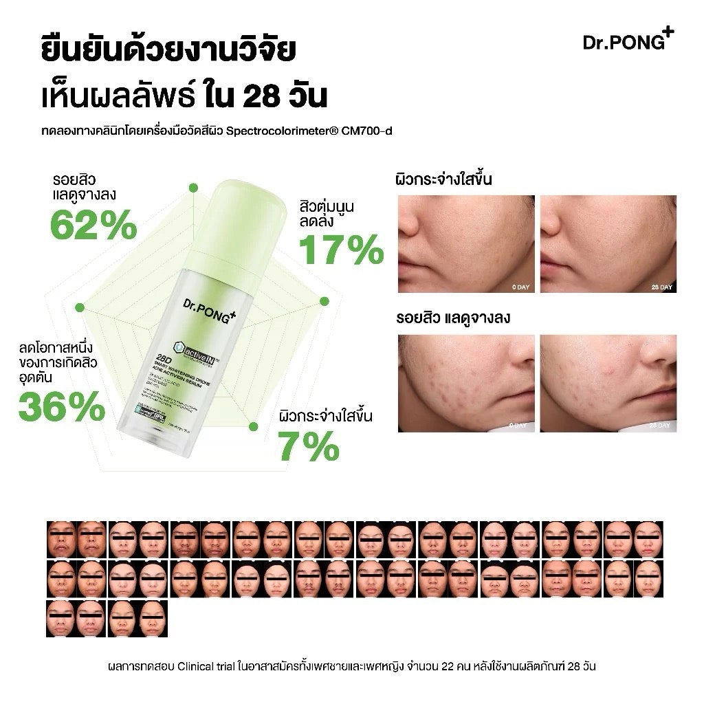 สูตรใหม่ ✨ DR.PONG 28D Acne activeIN™ เซรั่มช่วยเคลียร์สิวจากต้นตอ 30ml