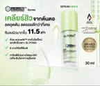 สูตรใหม่ ✨ DR PONG 28D Acne activeIN™ เซรั่มช่วยเคลียร์สิวจากต้นตอ 30ml