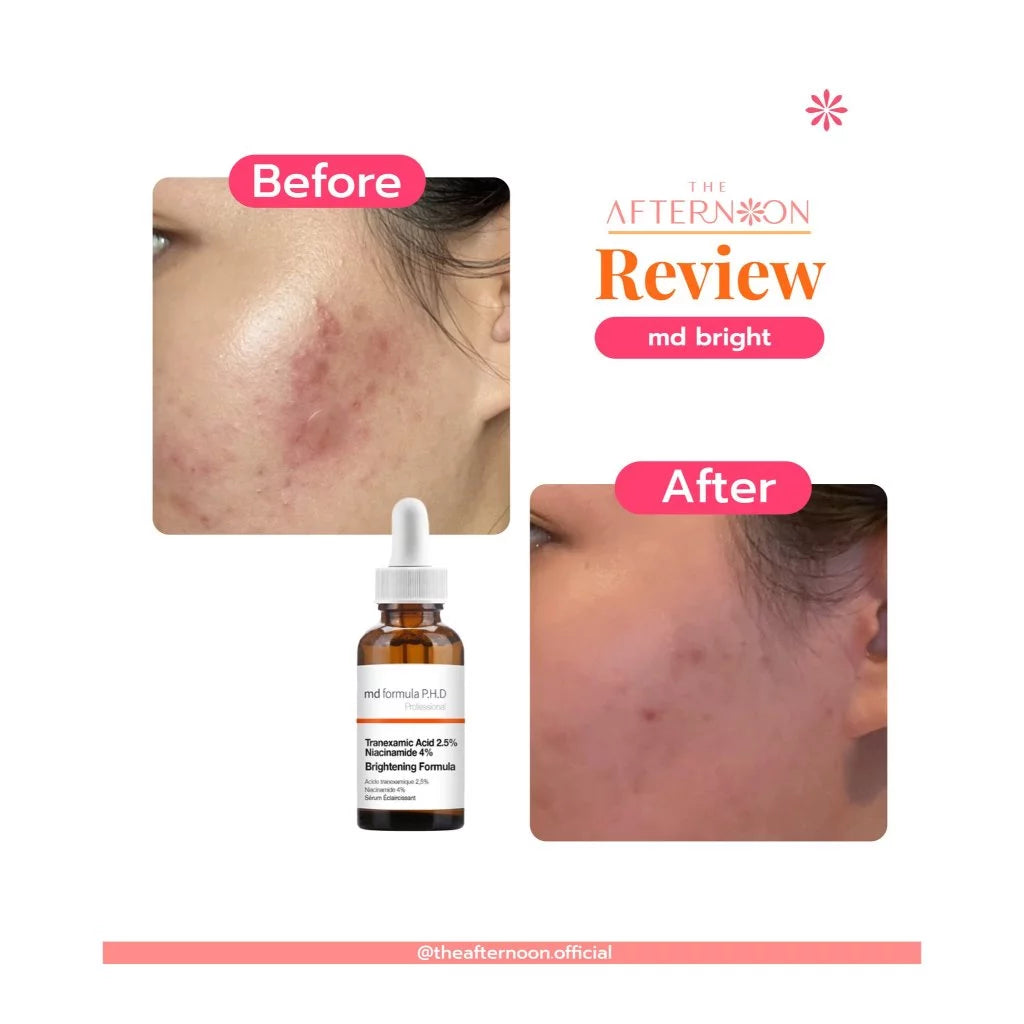 ⛔️ (Pre-order) The Afternoon MD Formula Brightening Serum เซรั่มปรับผิวกระจ่างใส 30ml