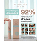 Moleculogy AcneDecode Serum เซรั่มดูแลปัญหาสิวสูตรเข้มข้น 50ml