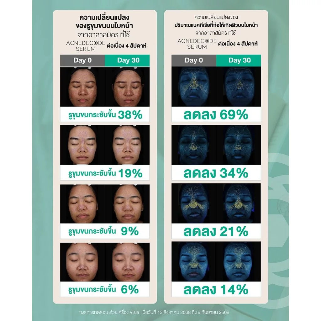 Moleculogy AcneDecode Serum เซรั่มดูแลปัญหาสิวสูตรเข้มข้น 50ml