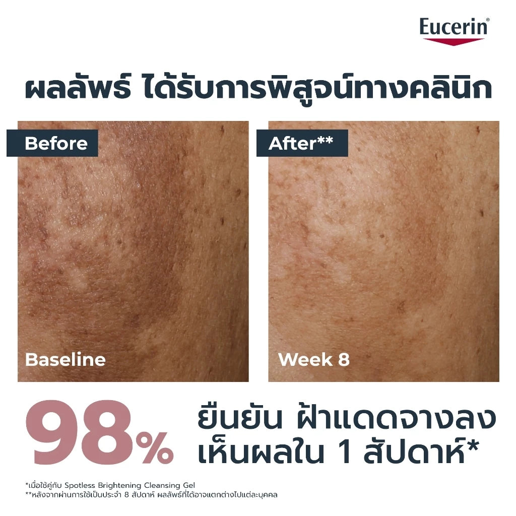 ⛔️ (Pre-order) Eucerin Spotless Thiamidol Serum  เซรั่มจัดการฝ้าแดด กระ จุดด่างดำ 30 ml